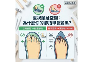 【重視腳趾空間:為什麼你的腳指甲會變黑?】 【重視腳趾空間:為什麼你的腳指甲會變黑?】