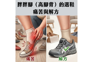 胖胖腳（高腳背）的選鞋痛苦與解方