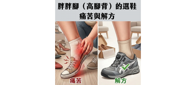 胖胖腳（高腳背）的選鞋痛苦與解方